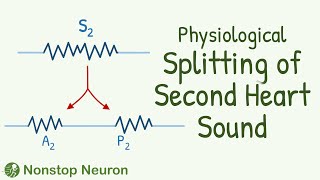 When SUPERMAN Auscultates the Heart Physiological Splitting of Second Heart Sound is heard [upl. by Skipper814]