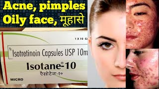 Isotane10 capsules uses in hindi [upl. by Howe]