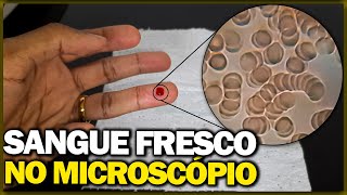 Analisando sangue fresco no microscópio [upl. by Hufnagel613]