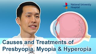 Causes and Treatments of Presbyopia Myopia amp Hyperopia [upl. by Aitnuahs]