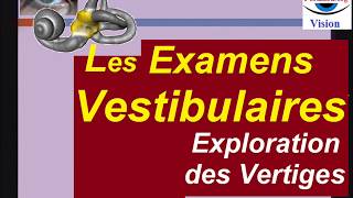 Différents examens vestibulaires diagnostic des vertiges [upl. by Wier]