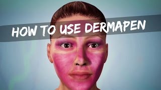 How To Use Dermapen Personal Step By Step Cara Guna Dermapen [upl. by Idnahc]