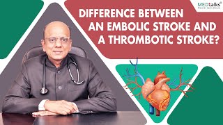 Difference between an Embolic stroke and a thrombotic stroke  Dr K K Aggarwal  Medtalks [upl. by Hung]