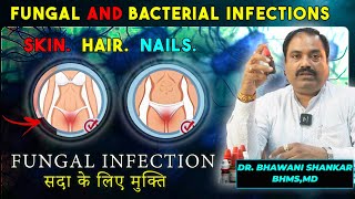 Fungal and Bacterial Infection in private part  Hair  Skin  Nail Homepathic medicine  Dr bhawani [upl. by Kris]