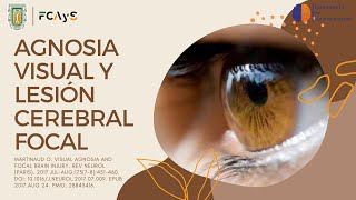 Agnosia Visual y Lesión Cerebral Focal [upl. by Bolton]