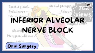 Inferior Alveolar Nerve Block Technique [upl. by Tnecillim799]