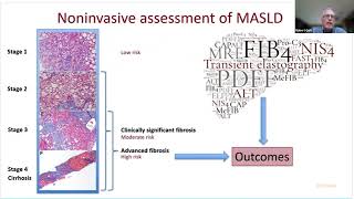 MAFLD MASLD NASH [upl. by Sinnaiy]