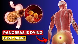 6 Symptoms of PANCREATIC CANCER That Will SHOCK YOU  Critical Warning Signs [upl. by Ran209]