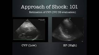 Approach to Shock Using Ultrasound by Dr Zevallos [upl. by Clova235]