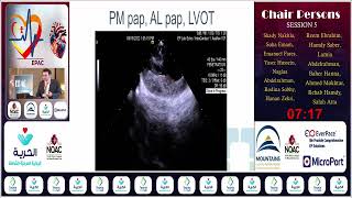 EPAC 24  S5  Utility of Intracardiac Echocardiography in EP Studies  Dr Shady Nakhla [upl. by Cogswell212]