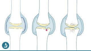 Starke Gelenke 💪 Was macht das Knie gesund und glücklich [upl. by Brey376]