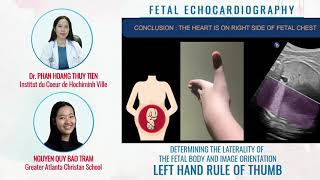 DETERMINING THE LATERALITY OF THE FETAL BODY AND IMAGE ORIEBTATION  FETAL ECHOCARDIOGRAPHY [upl. by Nyllewell280]