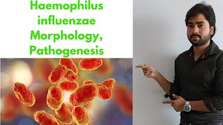 HAEMOPHILUS INFLUENZAE  Morphology  Classification  Pathogenesis By Abhishek sir [upl. by Gord]