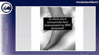 Scan technique for tendons with tenosynovitis in the tendon sheath [upl. by Shanda]