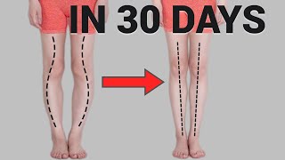 Get Straight Legs in 30 Days Fix O or XShaped Legs Knee Internal Rotation [upl. by Vaas]