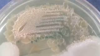 Moraxella lacunata  Pitted colonies [upl. by Aaberg]