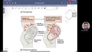 Rh Blood Group System and Haemolytic Diseases of Newborn [upl. by Terag]