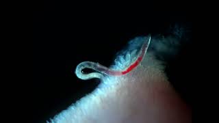 Bloodfeeding adult female Ancylostoma ceylanicum hookworm [upl. by Lertnom]