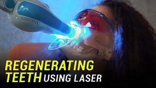 Researchers use lasers to regenerate teeth from stem cells [upl. by Schafer482]