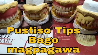 PUSTISO TIPS1 Bago mag pagawa ng Pustiso by DatuAmbasTv [upl. by Potts991]