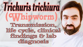 Lec26  Trichuris trichiura  Whipworm  Transmission  life cycle  clinical findings  UrduHindi [upl. by Raffarty454]