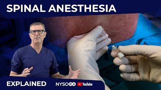 Spinal Anesthesia Explained Part 1 Crash course with Dr Hadzic [upl. by Emie]