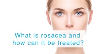 What is rosacea and how can it be treated [upl. by Arted26]