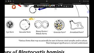 GIT Parasitology Lec 1 Blastocystis hominis [upl. by Sibeal954]