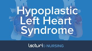 Hypoplastic Left Heart Syndrome HLHS  Pediatric Nursing [upl. by Nosnev]