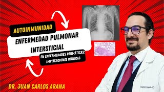 Enfermedad Pulmonar Intersticial en Reumatología [upl. by Valiant]