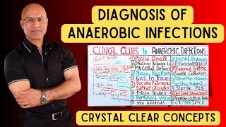 Diagnosis of Anaerobic Infections  Clinical Clues [upl. by Ytissahc831]