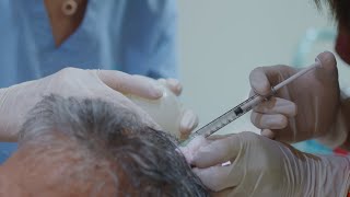 Stem Cells for Hair Growth [upl. by Phelgen232]