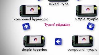 Types of astigmatism [upl. by Eirrem]