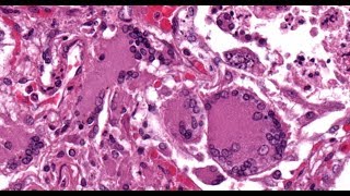 Canine Distemper Hyperkeratosis Meningoencephalitis Enamel Hypoplasia  Part 2 [upl. by Natanhoj]