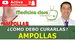 Ampollas ¿Hay que pincharlas Cómo curar una ampolla correctamente  Medicina Clara [upl. by Fagaly509]