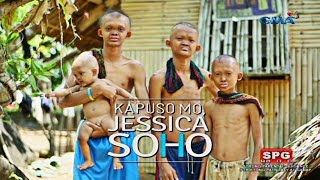 Kapuso Mo Jessica Soho The rare case of poreless skin in four siblings [upl. by Etterrag988]