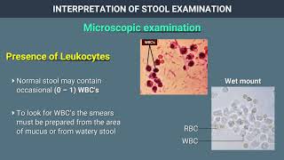 Interpretation of Stool Examination [upl. by Richma419]