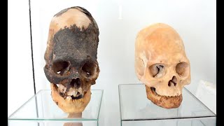 Face to Face with the Elongated Skulls of Paracas [upl. by Nalaf]