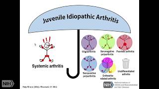 The Spectrum of Still’s Disease Genetics and Overlap with Autoinflammatory Diseases Part 2 [upl. by Oznol]