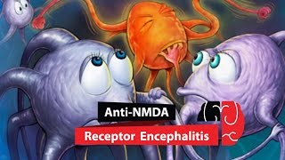 Anti NMDA Receptor Encephalitis [upl. by Omissam]