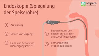 Speiseröhrenspiegelung Magenspiegelung  so läuft die Untersuchung ab Arzt informiert [upl. by Beutler]