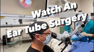 Ear Tube Surgery actual video  myringotomy tympanostomy ventilation tube placement [upl. by Gatian]