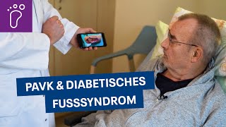 PAVK amp Diabetisches Fußsyndrom Behandlung im Evangelischen Krankenhaus Hubertus [upl. by Erik]