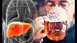 Anatomy and Physiology of Alcohol Effects Dangers  How Alcohol Effects [upl. by Lunneta834]