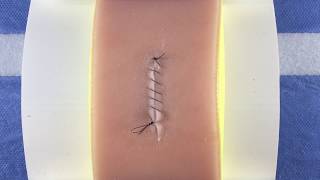 Simple Continuous Running Baseball Suture [upl. by Lirrad]