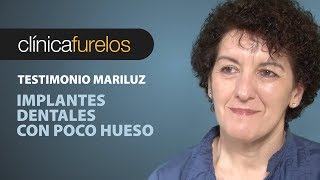 Mari Luz Implantes dentales con poco hueso [upl. by Lednyc]