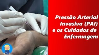 Pressão Arterial Invasiva PAI E os Cuidados de Enfermagem [upl. by Ahsienahs]