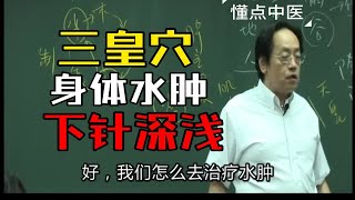 ”三皇穴“组合，治疗一切身体水肿！（医及理） [upl. by Qifar166]