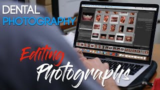 Dental Photography Basics  Editing Dental Photos [upl. by Wehhtam]