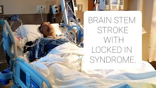 A BRAIN STEM STROKE WITH LOCKED IN SYNDROME [upl. by Higbee719]